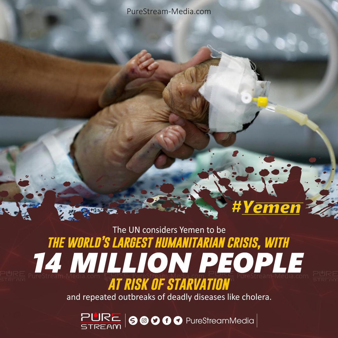 The UN considers Yemen…